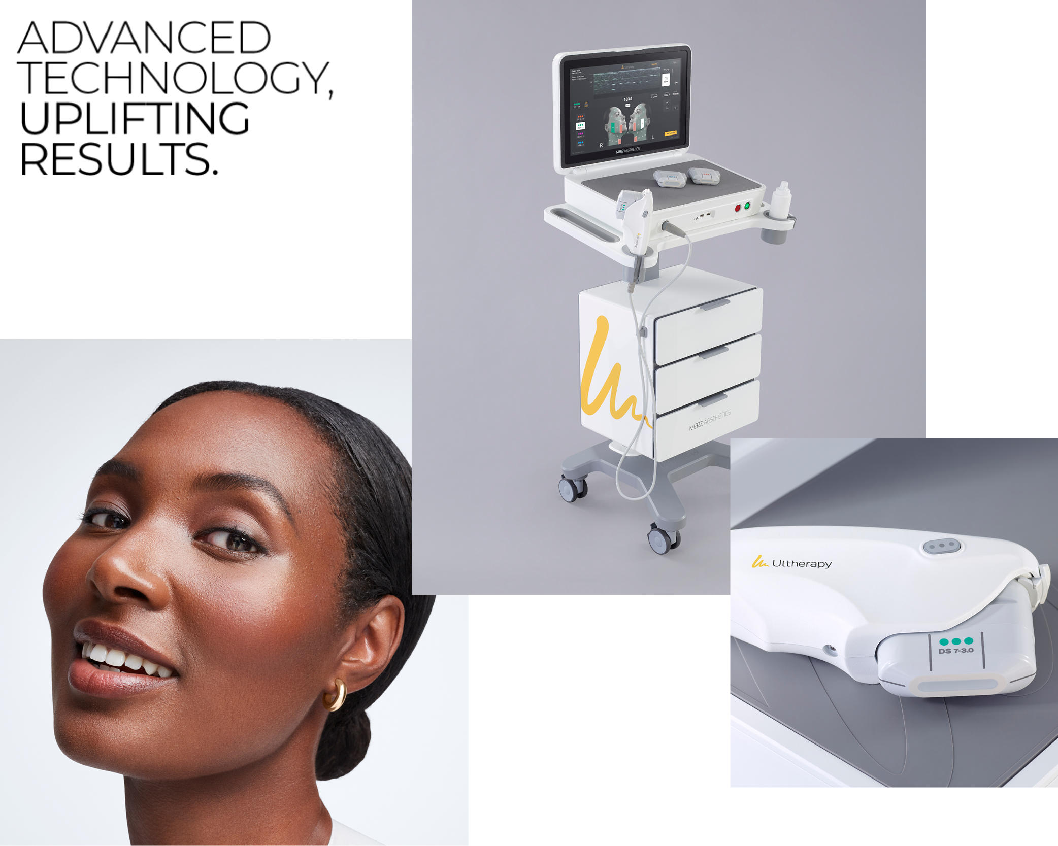 Come agisce Ultherapy PRIME - Lifting non invasivo